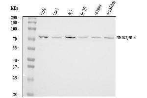 Western blot analysis of NPL4/NPLOC4 using anti-NPL4/NPLOC4 antibody (ABIN7599442).