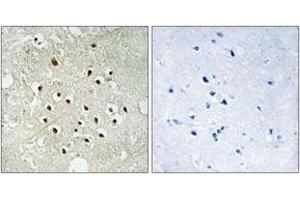 Immunohistochemistry analysis of paraffin-embedded human brain tissue, using RPS19BP1 Antibody. (RPS19BP1 antibody  (AA 71-120))