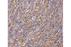 IHC analysis of SCRN1 using anti-SCRN1 antibody (ABIN7602923). (Secernin 1 antibody  (C-Term))