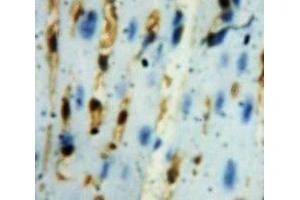 Used in DAB staining on fromalin fixed paraffin-embedded Heart tissue (GLRX3 antibody  (AA 10-117))