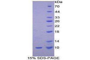 SDS-PAGE (SDS) image for Transforming Growth Factor, alpha (TGFA) (AA 24-98) protein (His tag) (ABIN1878913)