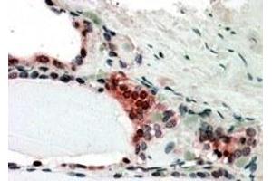 Immunohistochemistry (IHC) image for anti-Casein beta (CSN2) antibody (ABIN5859099) (CSN2 antibody)