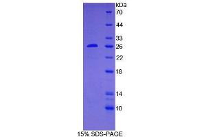 SDS-PAGE analysis of Human BCL2 Protein.
