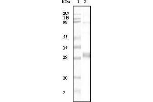 Western blot analysis using NPT mouse mAb against truncated NPT recombinant protein. (NPT antibody)
