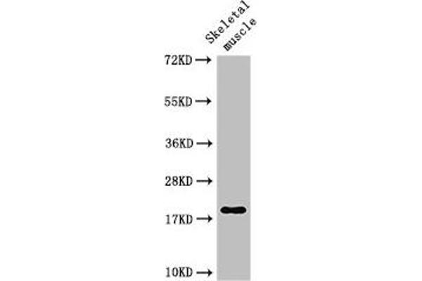 TNNC1 antibody  (AA 11-149)