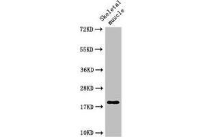 Western Blot Positive WB detected in: Rat skeletal muscle tissue All lanes: TNNC1 antibody at 3 μg/mL Secondary Goat polyclonal to rabbit IgG at 1/50000 dilution Predicted band size: 19 kDa Observed band size: 19 kDa (TNNC1 antibody  (AA 11-149))