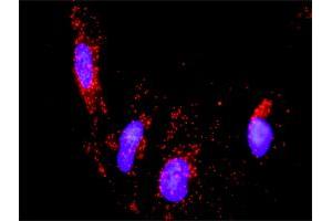 Proximity Ligation Analysis of protein-protein interactions between PTK2B and ERBB2. (PTK2B antibody  (AA 1-1009))
