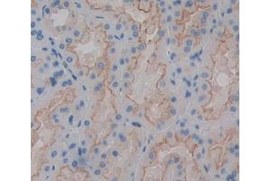 Used in DAB staining on fromalin fixed paraffin- embedded kidney tissue (ABCD4 antibody  (AA 356-606))