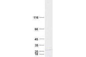 Western Blotting (WB) image for Mitochondrial Ribosomal Protein S25 (MRPS25) protein (Myc-DYKDDDDK Tag) (ABIN2726384)
