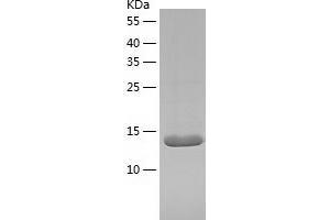 Western Blotting (WB) image for Myoglobin (MB) (AA 2-154) protein (His tag) (ABIN7284962) (Myoglobin Protein (MB) (AA 2-154) (His tag))