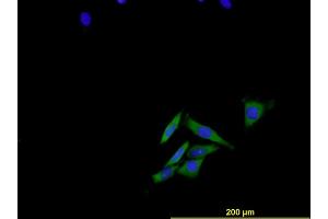 Immunofluorescence of monoclonal antibody to ENG on HeLa cell . (Endoglin antibody  (AA 27-658))