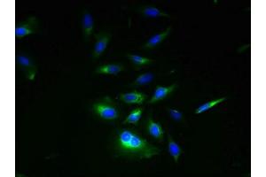 Immunofluorescent analysis of Hela cells using ABIN7151144 at dilution of 1:100 and Alexa Fluor 488-congugated AffiniPure Goat Anti-Rabbit IgG(H+L) (RNF133 antibody  (AA 65-167))