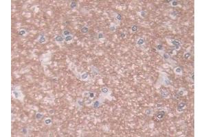 DAB staining on IHC-P; Samples: Human Cerebrum Tissue (SEMG1 antibody  (AA 24-462))
