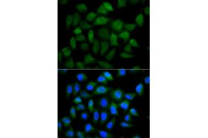 Immunofluorescence analysis of HeLa cells using AFP antibody (ABIN5970034). (alpha Fetoprotein antibody  (C-Term))