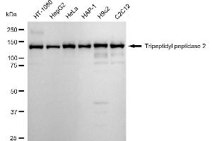 Western blotting analysis using Tripeptidyl peptidase 2 antibody (ABIN7800646).