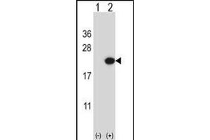 Western blot analysis of EDN2 (arrow) using rabbit polyclonal EDN2 Antibody (C-term) (ABIN657784 and ABIN2846758).