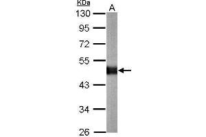 CPE antibody