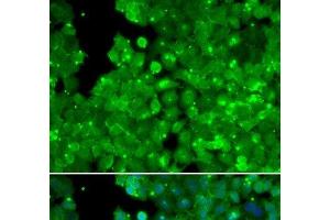 Immunofluorescence analysis of U2OS cells using IL10RA Polyclonal Antibody (IL-10RA antibody)