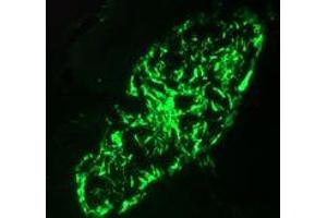 Immunofluorescence staining of a 7 days old zebrafish embryo (KRT8 antibody)
