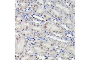 Immunohistochemistry of paraffin-embedded mouse kidney using Phospho-JNK1/2/3-T183/T183/T221 antibody (ABIN6135251, ABIN6135990, ABIN6135991 and ABIN7101879) at dilution of 1:100 (40x lens). (MAPK8/9/10 antibody  (pThr183, pThr221, Thr183))