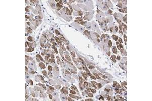 Immunohistochemical staining of human heart muscle with NEBL polyclonal antibody  shows strong cytoplasmic positivity in myocytes at 1:50-1:200 dilution. (Nebulette antibody)