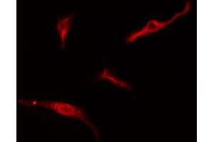 ABIN6274765 staining HeLa cells by IF/ICC. (RPL10A antibody  (C-Term))