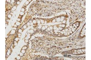 Image no. 1 for anti-N-Myc (And STAT) Interactor (NMI) (AA 1-101) antibody (ABIN598596) (NMI antibody  (AA 1-101))