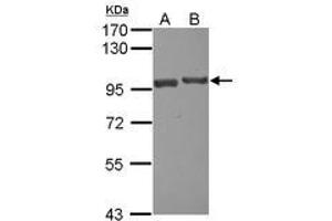 Image no. 1 for anti-USP6 N-terminal Like (USP6NL) (N-Term) antibody (ABIN1494111) (USP6NL antibody  (N-Term))