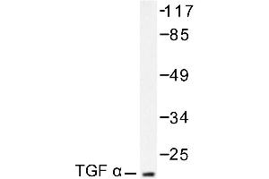 Image no. 1 for anti-Transforming Growth Factor, alpha (TGFA) antibody (ABIN271847)