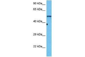 Host:  Mouse  Target Name:  DES  Sample Tissue:  Mouse Skeletal Muscle  Antibody Dilution:  1ug/ml (Desmin antibody  (N-Term))