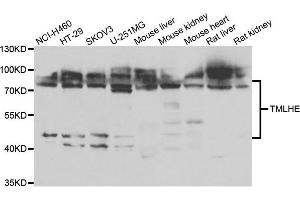 Western blot analysis of extracts of various cell lines, using TMLHE antibody.