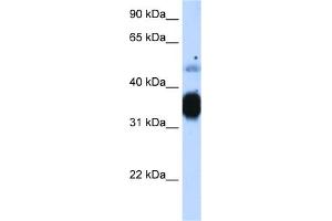 WB Suggested Anti-TNNT3 Antibody Titration:  1. (TNNT3 antibody  (N-Term))