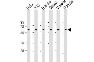 Western Blot at 1:2000 dilution Lane 1: Hela whole cell lysate Lane 2: 293 whole cell lysate Lane 3: human testis lysate Lane 4: Caco2 whole cell lysate Lane 5: mouse testis lysate Lane 6: rat testis lysate Lysates/proteins at 20 ug per lane. (SLC2A8 antibody  (AA 260-292))