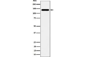 Western blot analysis of CYFIP1 expression in HeLa cell lysate. (Recombinant CYFIP1 antibody)