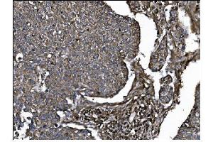 IHC analysis of CD39/ENTPD1 using anti-CD39/ENTPD1 antibody (ABIN7602461). (CD39 antibody  (AA 79-411))