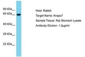 Image no. 1 for anti-Anaphase Promoting Complex Subunit 7 (ANAPC7) (AA 387-436) antibody (ABIN6750413) (ANAPC7 antibody  (AA 387-436))