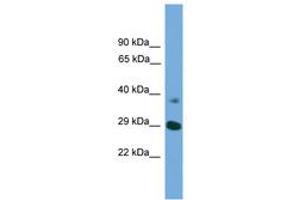 Image no. 1 for anti-ATG16 Autophagy Related 16-Like 1 (ATG16L1) (AA 121-170) antibody (ABIN6745321) (ATG16L1 antibody  (AA 121-170))