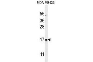 CU002 Antibody (C-term) western blot analysis in MDA-MB435 cell line lysates (35µg/lane). (C21orf2 antibody  (C-Term))