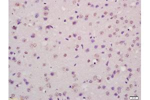 Formalin-fixed and paraffin embedded mouse brain labeled with Rabbit Anti-P73 protein Polyclonal Antibody, Unconjugated  at 1:200 followed by conjugation to the secondary antibody and DAB staining