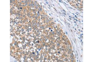 Immunohistochemistry (IHC) image for anti-3'-phosphoadenosine 5'-phosphosulfate Synthase 1 (PAPSS1) antibody (ABIN2422763) (PAPSS1 antibody)