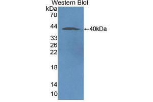 Western blot analysis of the recombinant protein. (NOX5 antibody  (AA 456-765))