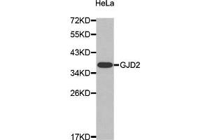Western Blotting (WB) image for anti-Gap Junction Protein, delta 2, 36kDa (GJD2) (AA 99-197) antibody (ABIN3016909) (GJD2 antibody  (AA 99-197))