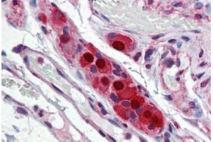 Human Small Intestine, Submucosal Plexus: Formalin-Fixed, Paraffin-Embedded (FFPE) (ELAVL4 antibody  (AA 312-381))