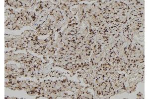 ABIN6272261 at 1/100 staining Human lung tissue by IHC-P. (CEBPZ antibody  (N-Term))