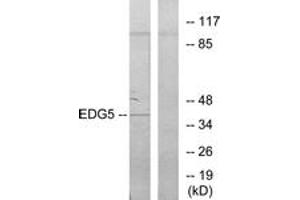 Western blot analysis of extracts from COLO205 cells, using EDG5 Antibody. (S1PR2 antibody  (AA 261-310))
