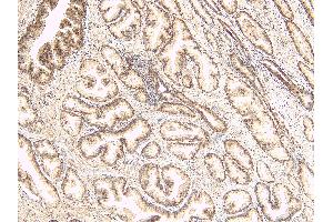 ABIN334520 (8µg/ml) staining of paraffin embedded Human Prostate.