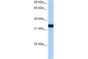 Western Blotting (WB) image for anti-GTPase, IMAP Family Member 1 (GIMAP1) antibody (ABIN2463329) (GTPase, IMAP Family Member 1 (GIMAP1) antibody)