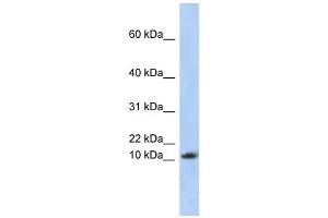 RPL30 antibody used at 1 ug/ml to detect target protein.