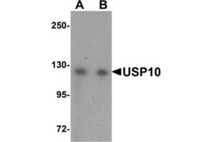 Western blot analysis of USP10 in Jurkat cell lysate with USP10 antibody at (A) 1 and (B) 2 μg/ml. (USP10 antibody  (N-Term))