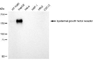 Western blotting analysis using Epidermal growth factor receptor antibody (ABIN7798477).